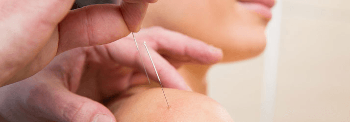 Chiropractic Omaha NE Dry Needling Services